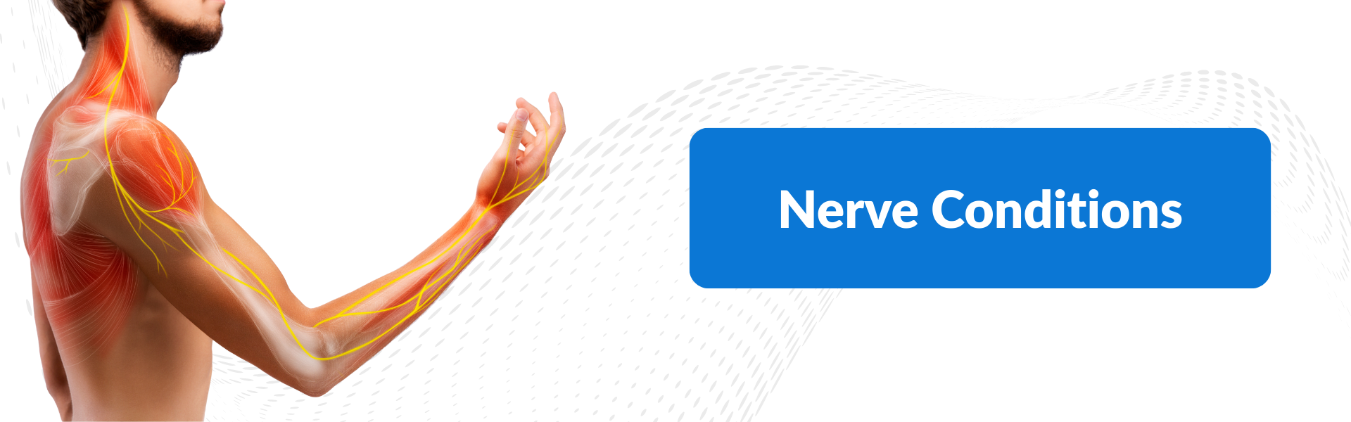 Nerve Conditions