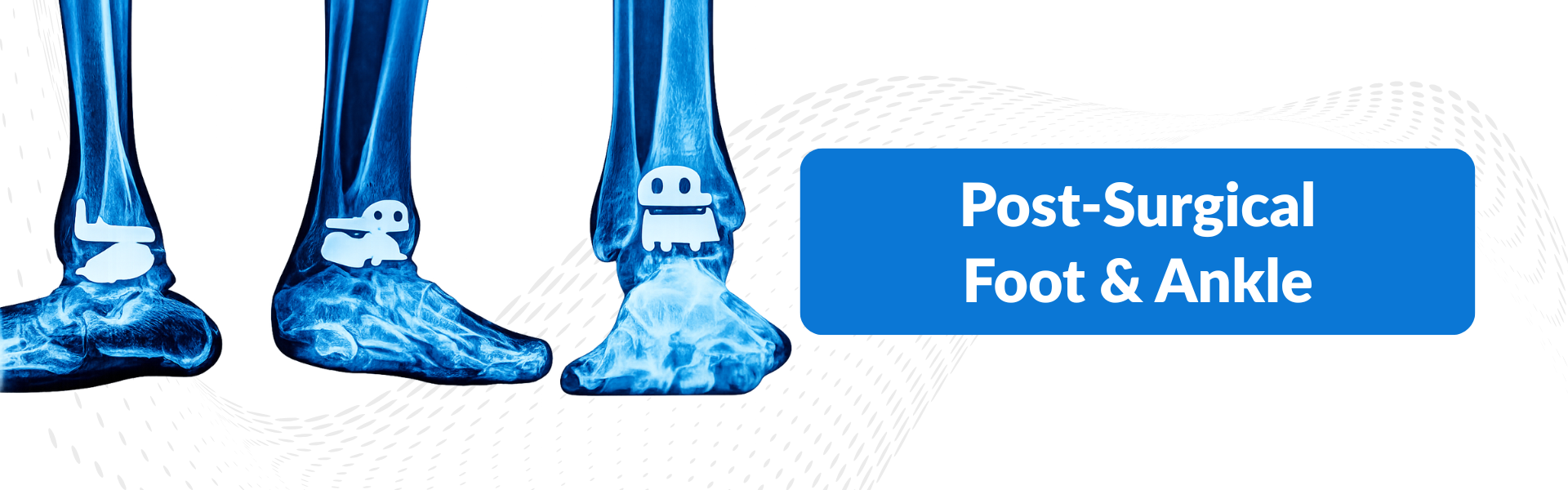 Post Surgical Foot & Ankle