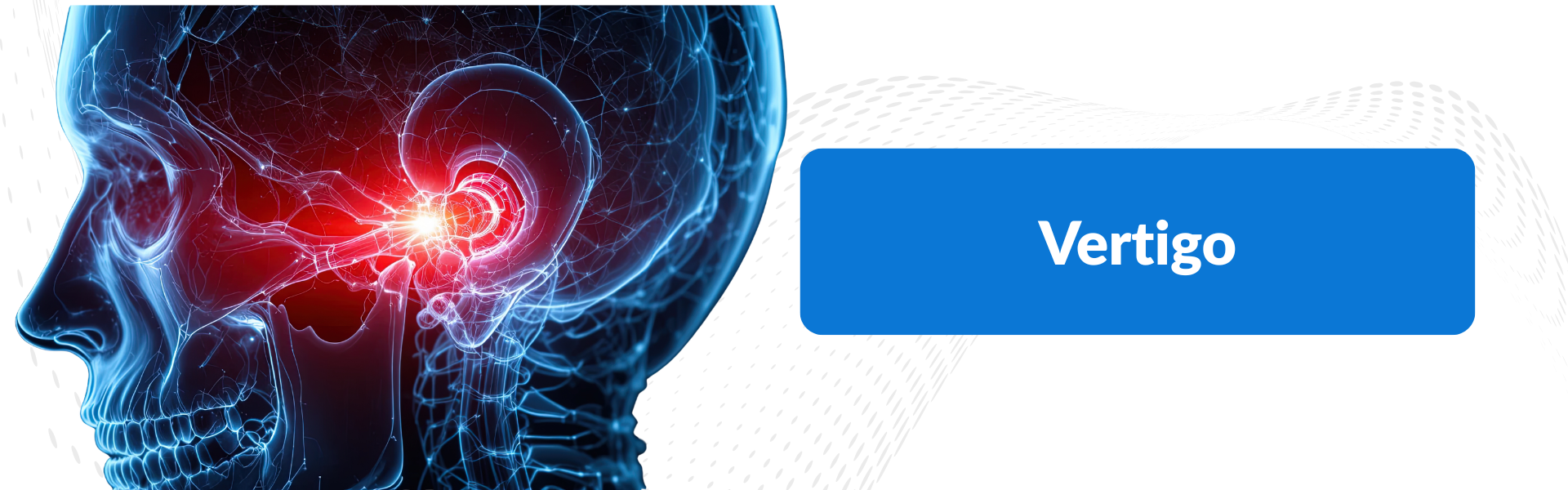 Vertigo